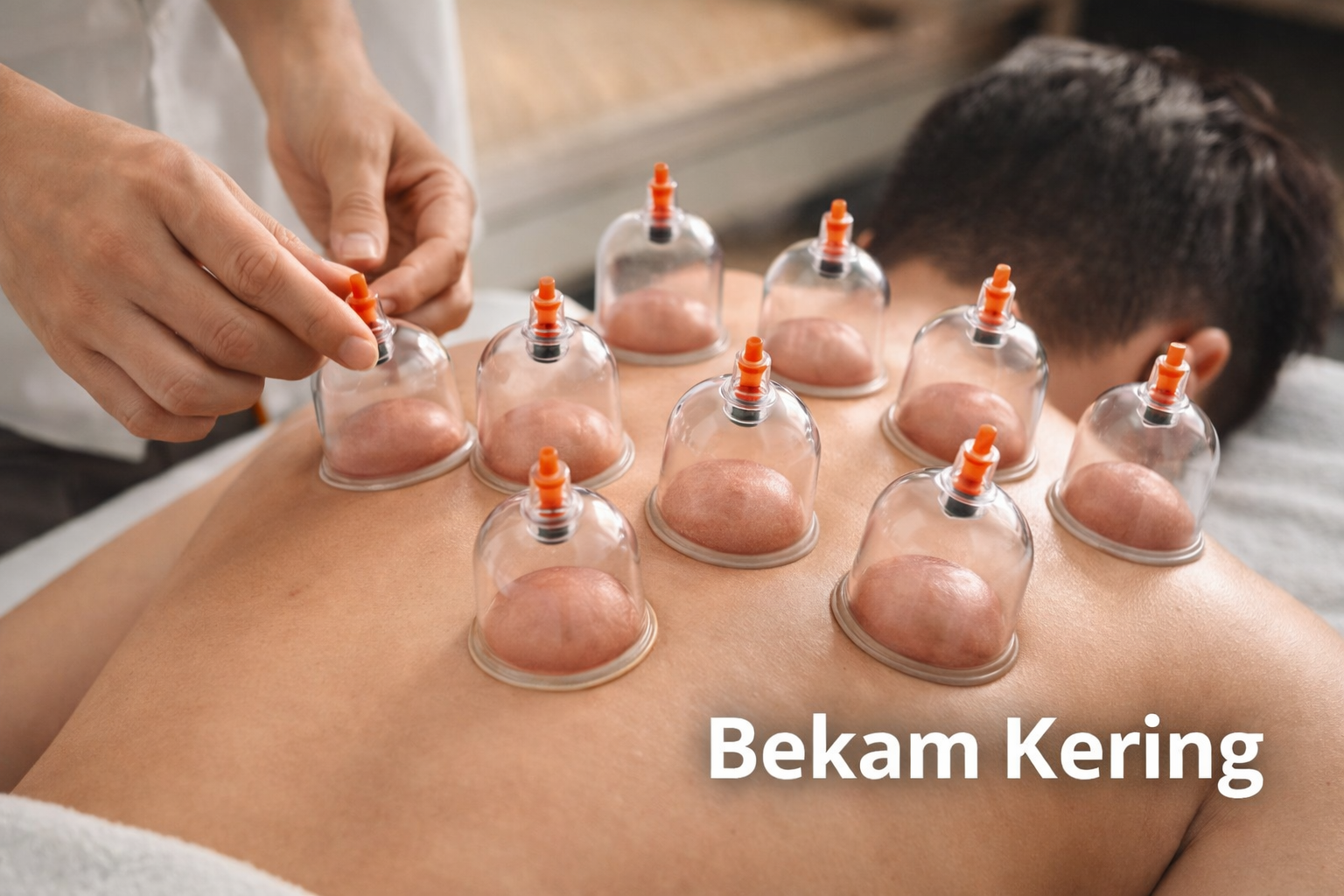 Bekam kering Bandung